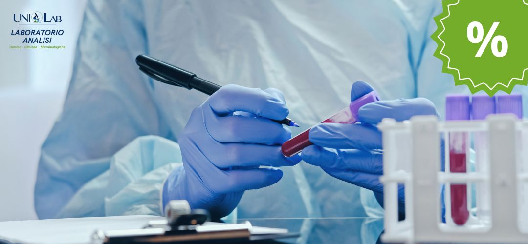 Check-up profilo lipidico
